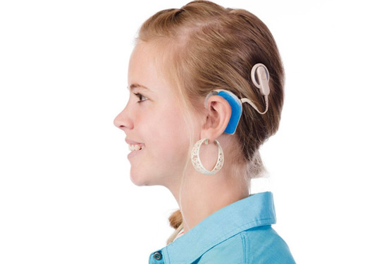 Cochlear-Implant